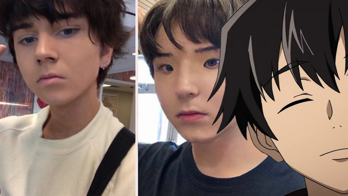 Kids are getting surgery to look like anime characters and BTS members