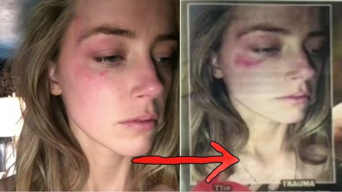 The Sun photoshopped Amber Heard fake injuries/abuse pictures